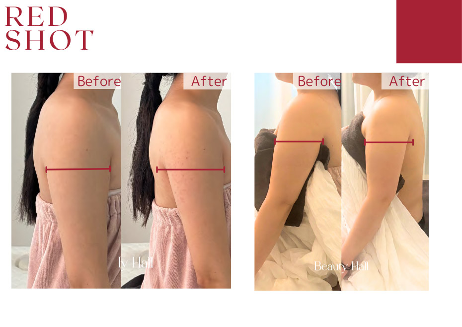 before　after写真