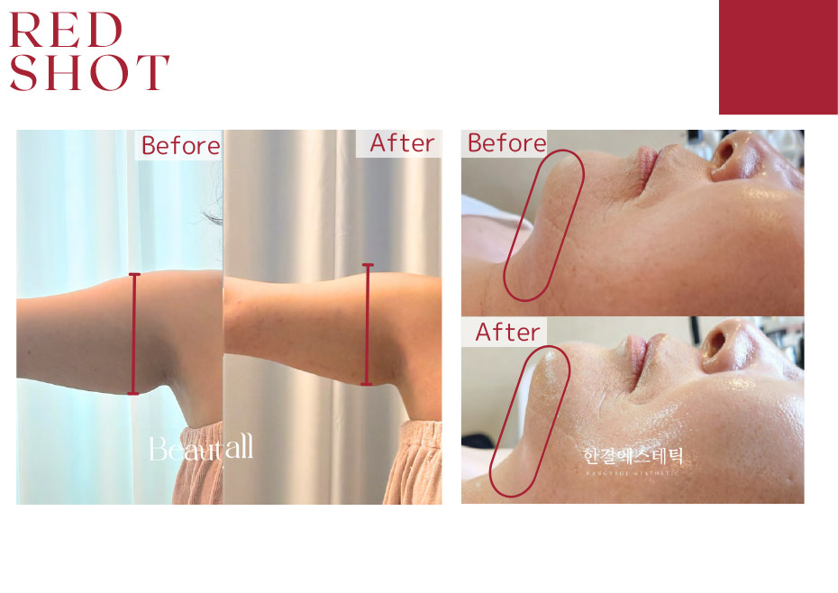 before　after写真