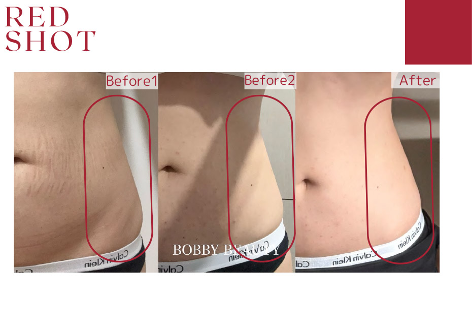 before　after写真