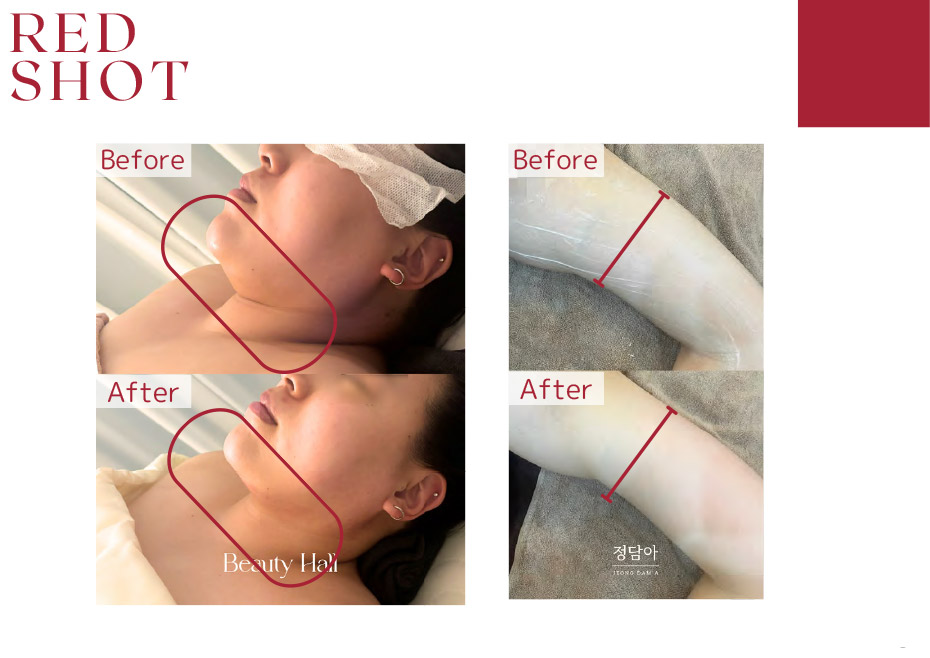 before　after写真