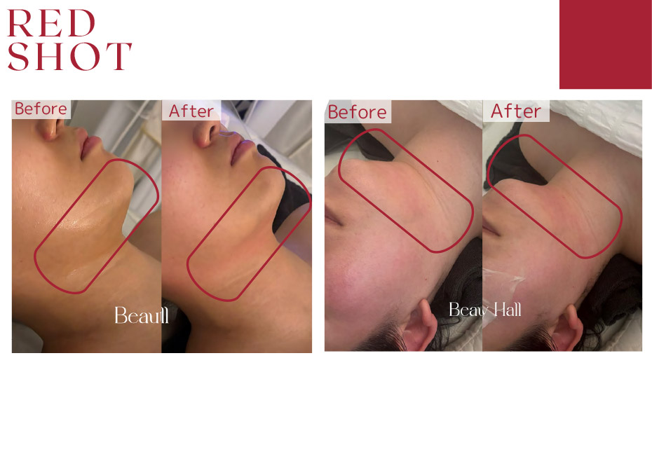 before　after写真