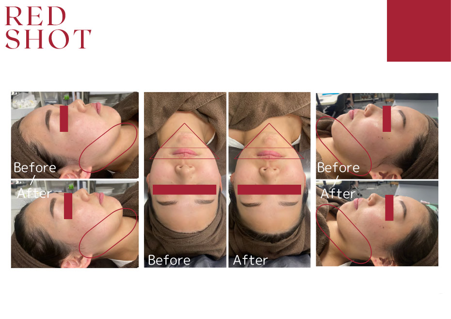 before　after写真